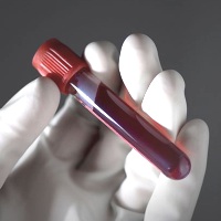 повышенный гемоглобин в крови