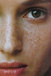 Пигментные пятна на лице - можно ли с ними справиться самостоятельно? 