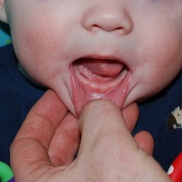 появление зубов у малыша